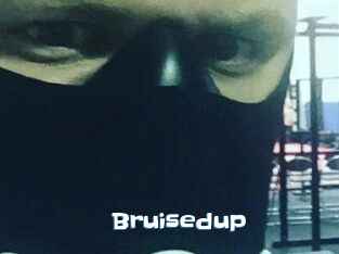 Bruisedup